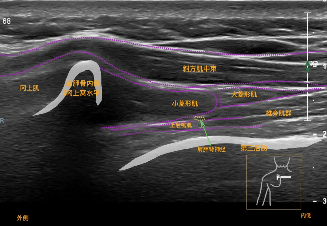 超声穿刺介入与肌骨超声的功能及临床检查范围